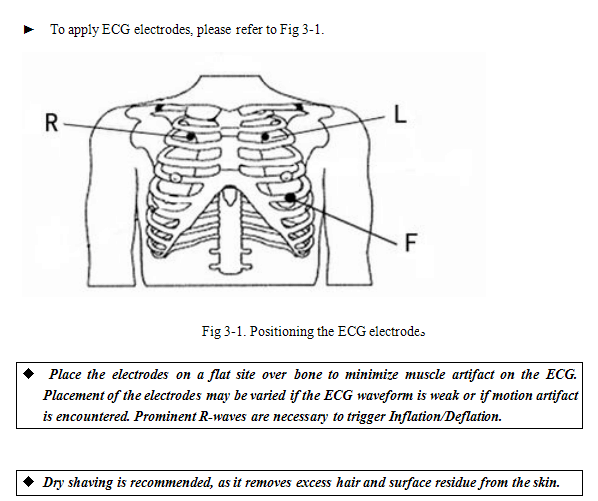 Apply ECG electrodes to the right place